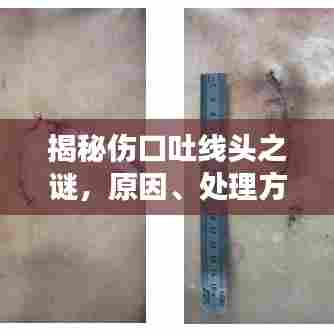揭秘伤口吐线头之谜,原因、处理方法及预防措施