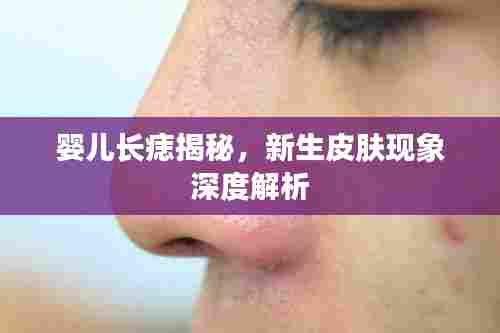 婴儿长痣揭秘,新生皮肤现象深度解析