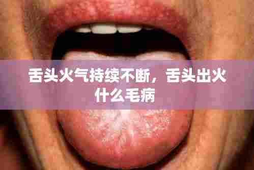 舌头火气持续不断,舌头出火什么毛病