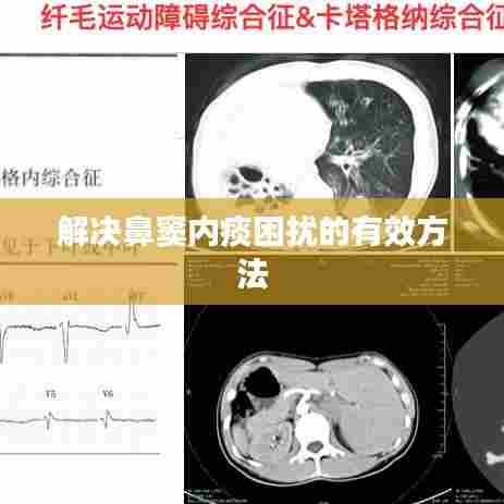 解决鼻窦内痰困扰的有效方法