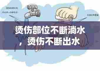 烫伤部位不断淌水，烫伤不断出水 