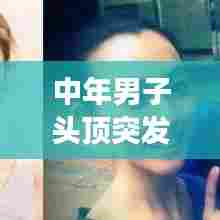 中年男子头顶突发脱发危机，揭秘男性脱发问题，守护头顶健康