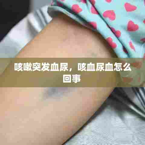 咳嗽突发血尿,咳血尿血怎么回事