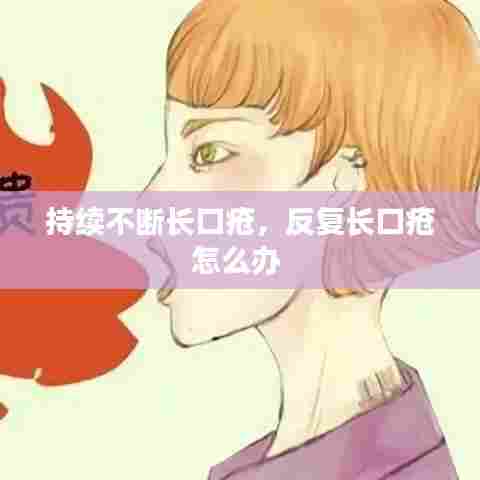 持续不断长口疮,反复长口疮怎么办