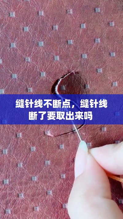 缝针线不断点，缝针线断了要取出来吗 