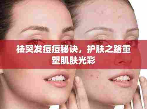 祛突发痘痘秘诀,护肤之路重塑肌肤光彩