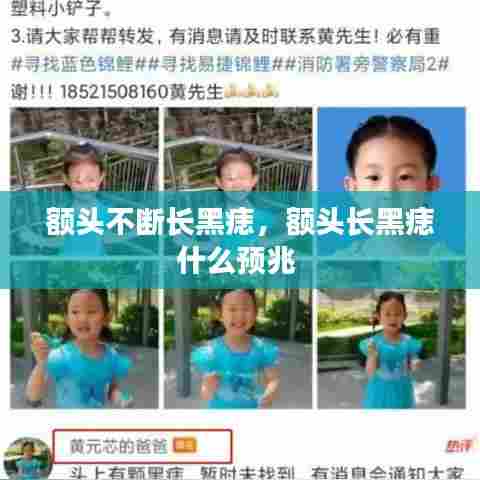 额头不断长黑痣,额头长黑痣什么预兆