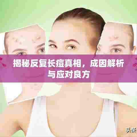 揭秘反复长痘真相，成因解析与应对良方