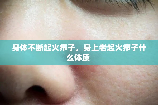 身体不断起火疖子,身上老起火疖子什么体质