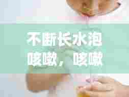 不断长水泡咳嗽，咳嗽有水泡音一定是肺炎吗 