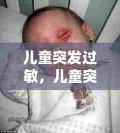 儿童突发过敏，儿童突发过敏全身红肿痒 眼睛也肿了怎么办 