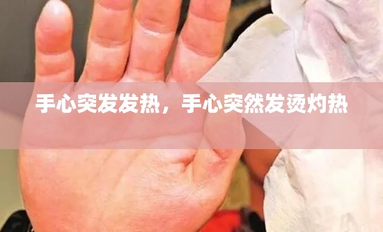 手心突发发热，手心突然发烫灼热 