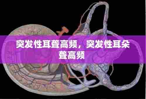 突发性耳聋高频,突发性耳朵聋高频