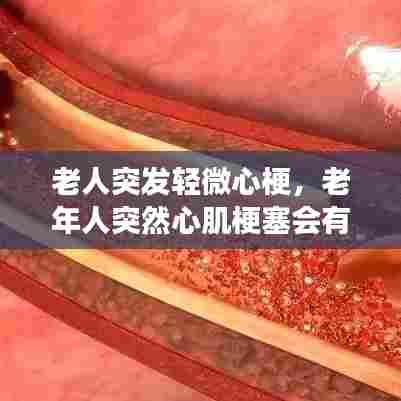 老人突发轻微心梗，老年人突然心肌梗塞会有生命危险吗 
