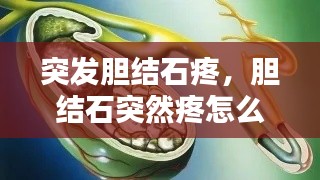 突发胆结石疼,胆结石突然疼怎么办