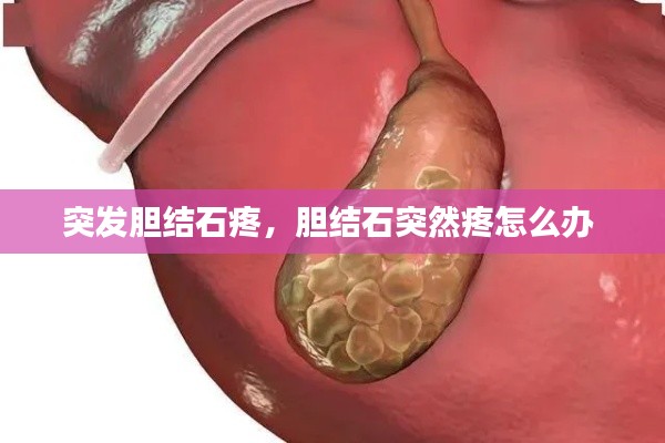 突发胆结石疼,胆结石突然疼怎么办
