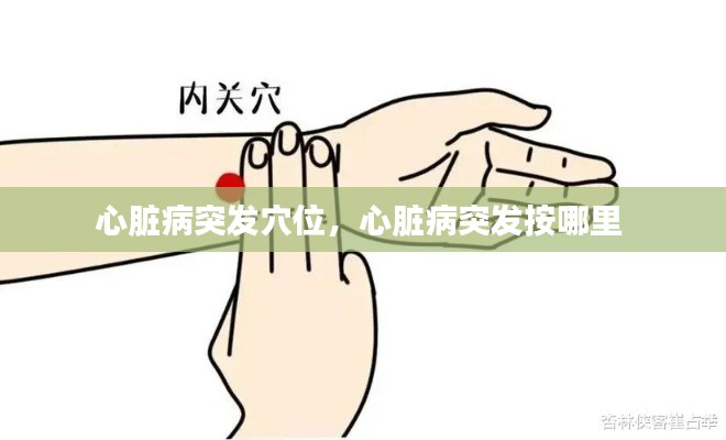 心脏病突发穴位,心脏病突发按哪里