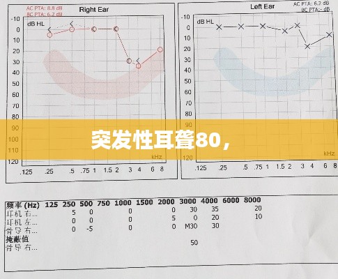 突发性耳聋80， 