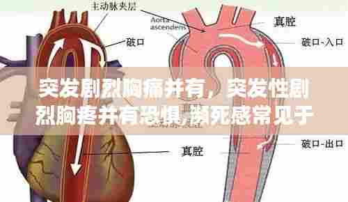 突发剧烈胸痛并有，突发性剧烈胸疼并有恐惧,濒死感常见于 