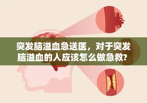 突发脑溢血急送医，对于突发脑溢血的人应该怎么做急救? 