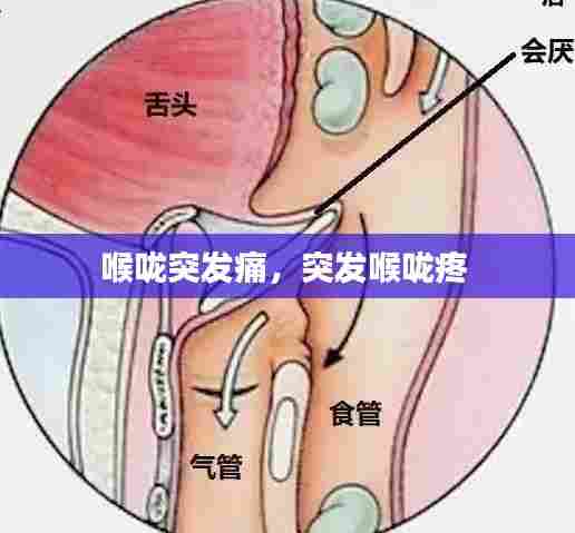 喉咙突发痛,突发喉咙疼