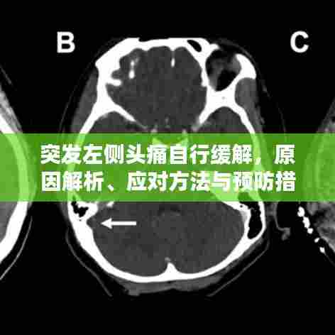 突发左侧头痛自行缓解，原因解析、应对方法与预防措施