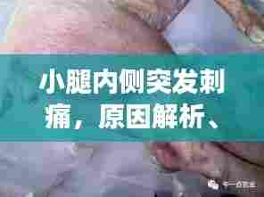小腿内侧突发刺痛，原因解析、症状表现及有效治疗方法