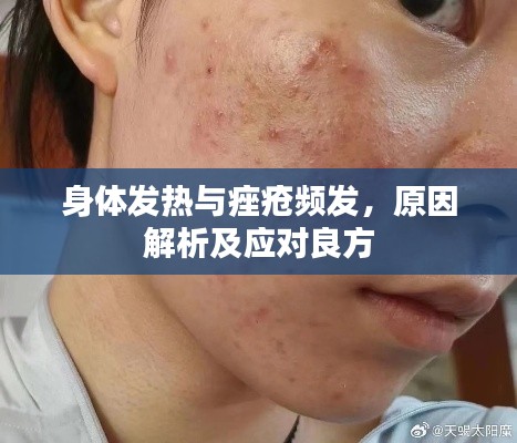 身体发热与痤疮频发,原因解析及应对良方