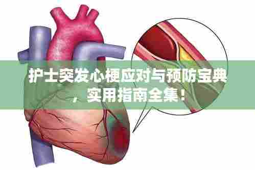 护士突发心梗应对与预防宝典,实用指南全集!