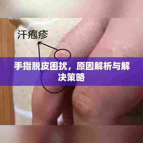 手指脱皮困扰，原因解析与解决策略