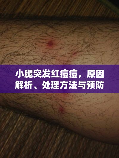 小腿突发红痘痘,原因解析、处理方法与预防策略