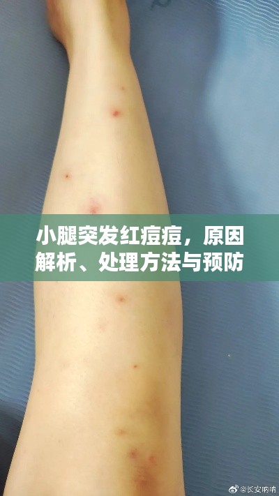 小腿突发红痘痘,原因解析、处理方法与预防策略