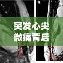 突发心尖微痛背后的真相揭秘