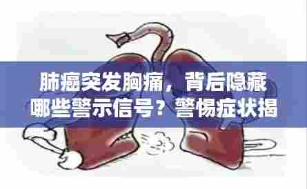 肺癌突发胸痛，背后隐藏哪些警示信号？警惕症状揭示真相！