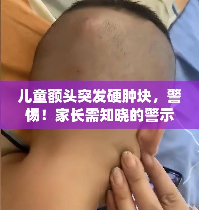 儿童额头突发硬肿块,警惕!家长需知晓的警示信号