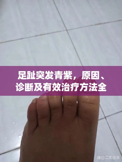 足趾突发青紫，原因、诊断及有效治疗方法全解析