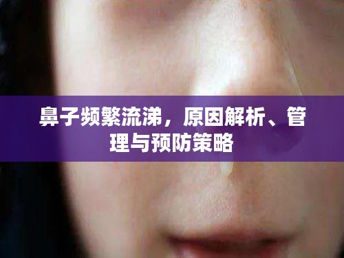 鼻子频繁流涕,原因解析、管理与预防策略