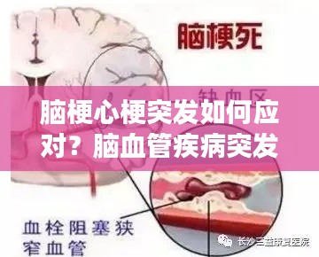 脑梗心梗突发如何应对?脑血管疾病突发处理指南