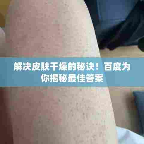 解决皮肤干燥的秘诀！百度为你揭秘最佳答案