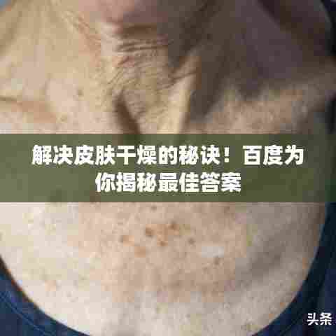 解决皮肤干燥的秘诀!百度为你揭秘最佳答案