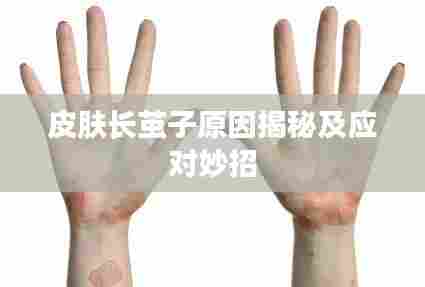 皮肤长茧子原因揭秘及应对妙招